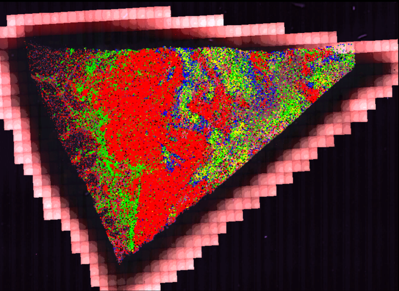 H&E Stain Analysis